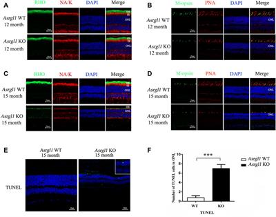 Deletion of Asrgl1 Leads to Photoreceptor Degeneration in Mice